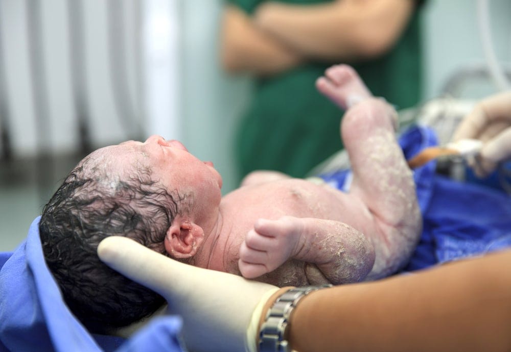 نوزاد در بدو تولد